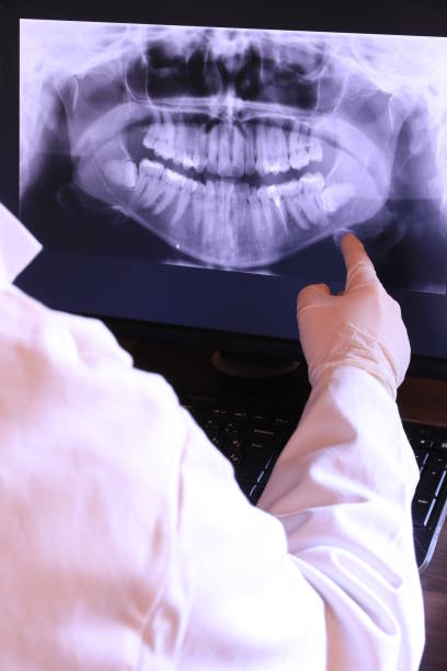 Best Chipped Tooth Repair Near Me  in Hauppauge, NY